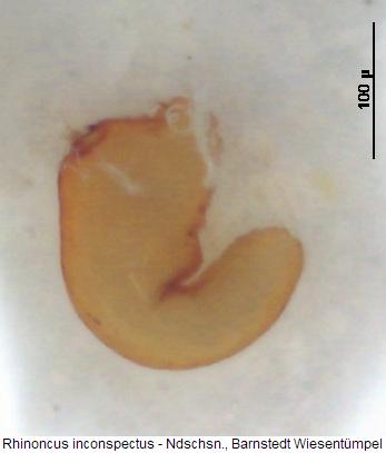 rhinoncus_inconspectus_sperm.jpg