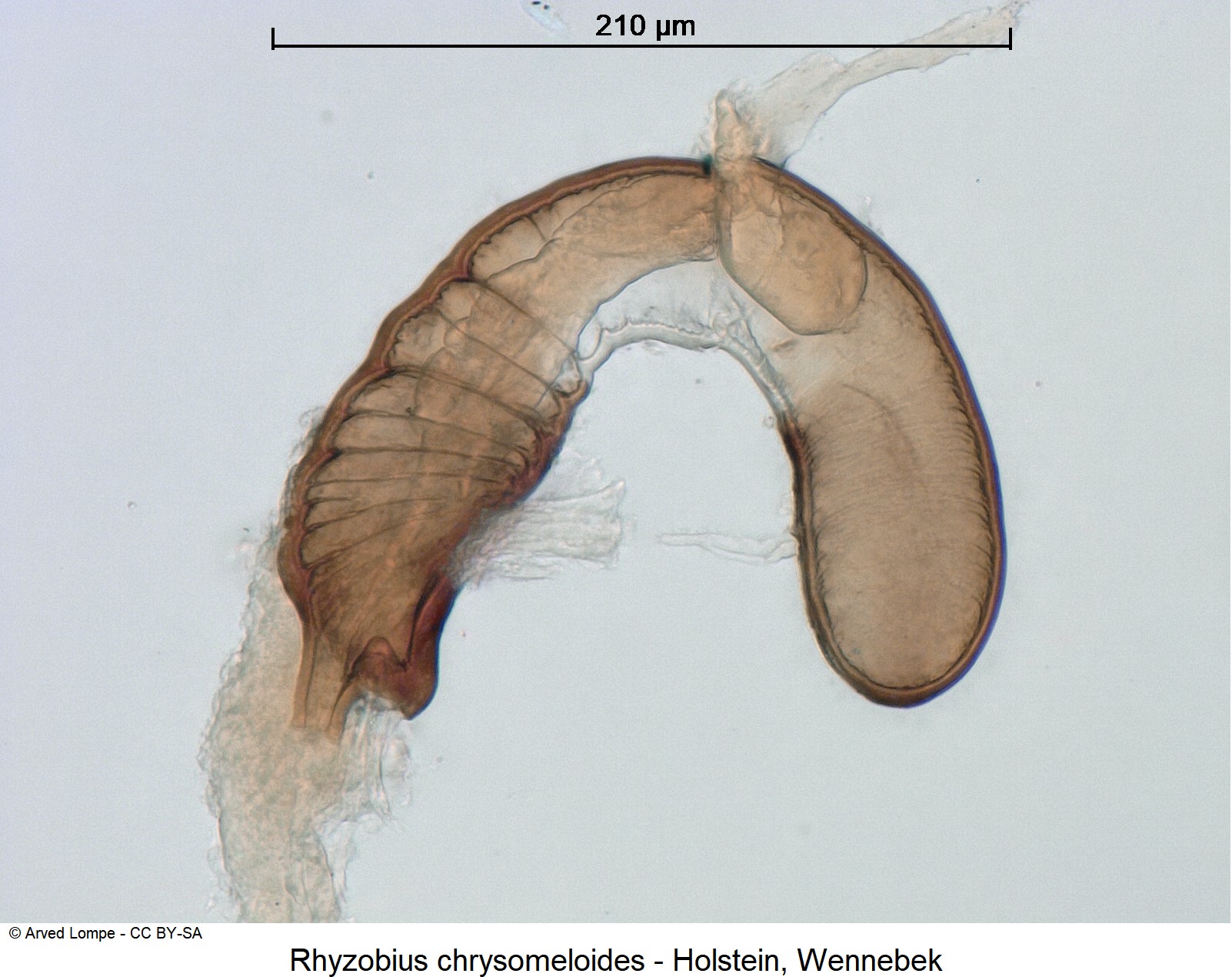 rhyzobius_chrysomeloides_ck8954_sperm.jpg