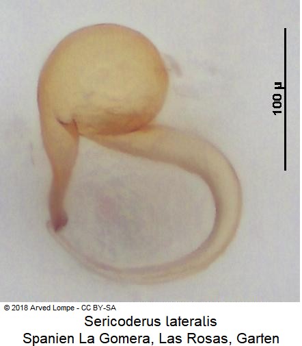 sericoderus_lateralis_sperm-1.jpg