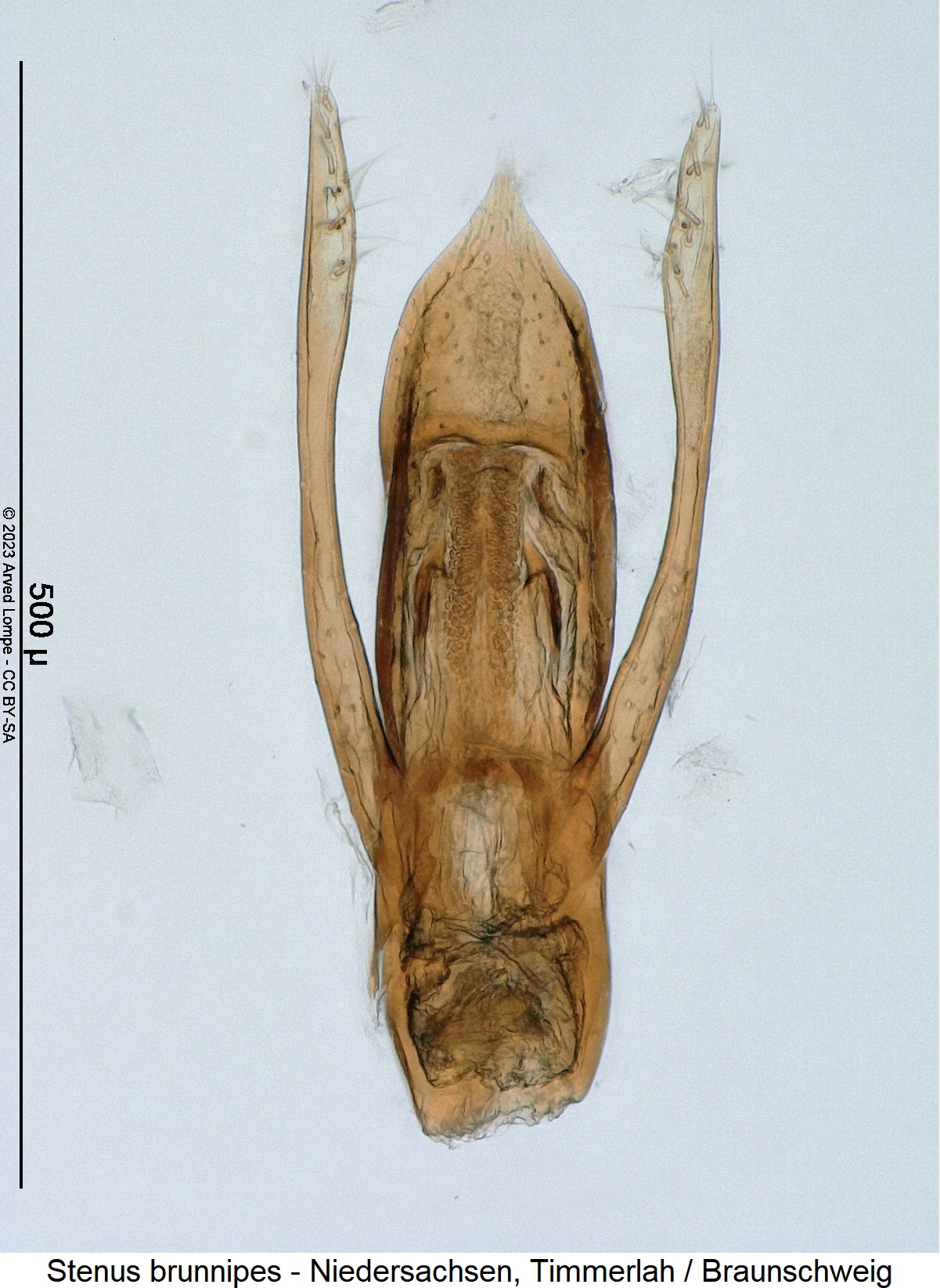 stenus_brunnipes1.jpg