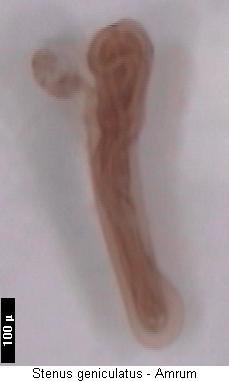 stenus_geniculatus_sperm.jpg
