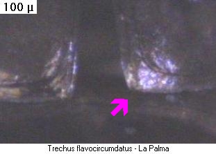 trechus_flavocircumdatus_fld.jpg
