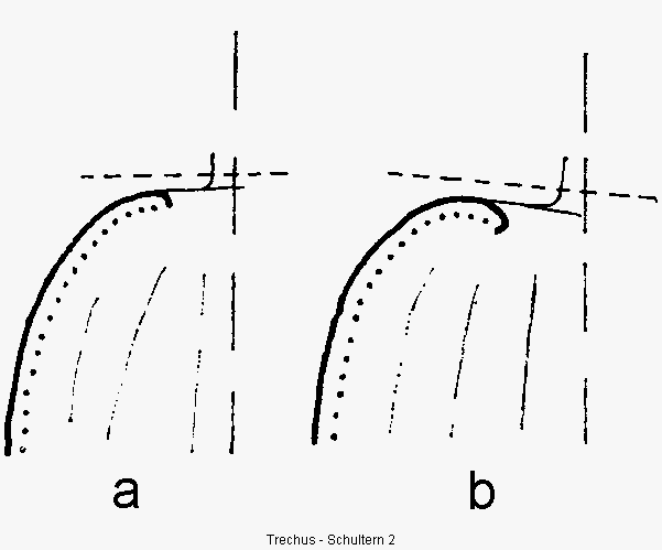 trechus_schulter2.gif